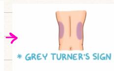 Grey Turner's Sign Diagram