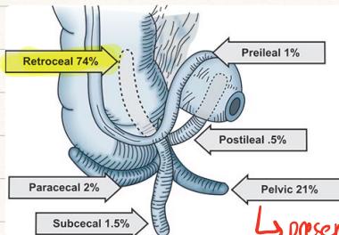 Appendicitis Ultrasound Scan