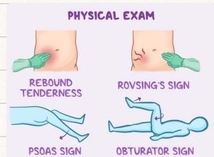 Retrocecal Appendicitis Anatomy