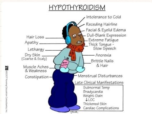 Hypothyroidism Clinical Features