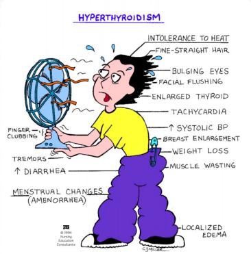 Hyperthyroidism Clinical Features