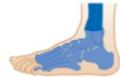 Toe Amputations