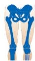 Transtibial Below Knee Amputation