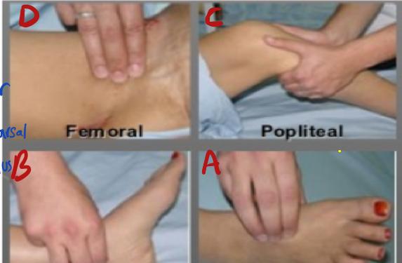 Lower Limb Arterial Pulse Palpation