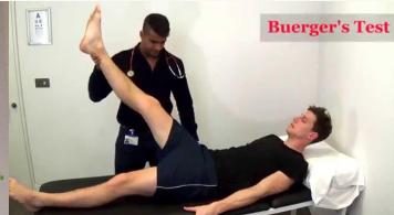 Buerger's Test Clinical Photo