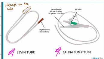 Levin vs Salem Sump Tubes