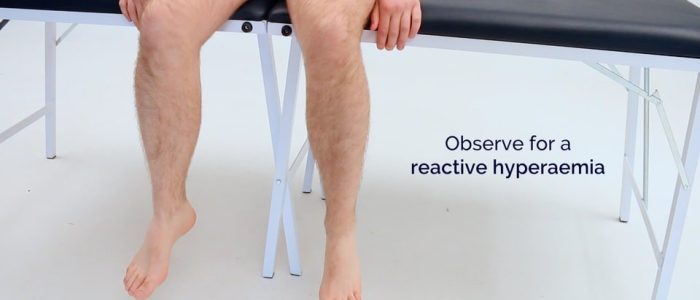 Buerger's test — reactive hyperaemia
