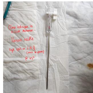 Veress Needle on Surface