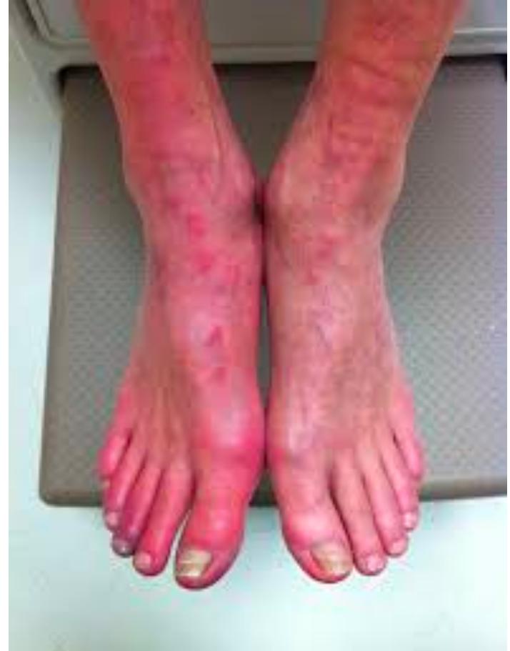 Lower Extremity Foot Findings