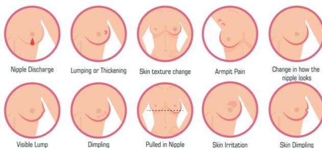 Clinical breast symptoms