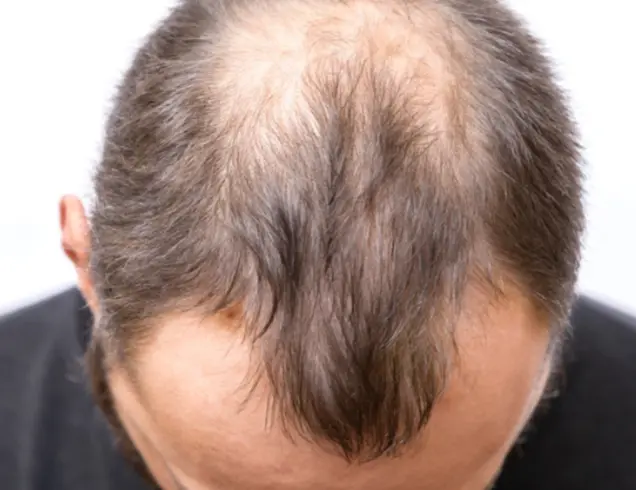 Derma-OSBE-1748023041257.webp|202x156