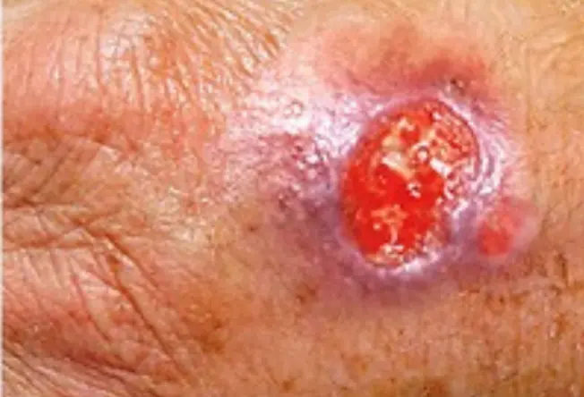 Derma-OSBE-1748023059294.webp|262x178