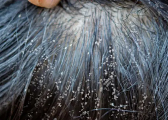 Derma-OSBE-1748023110527.webp|172x123