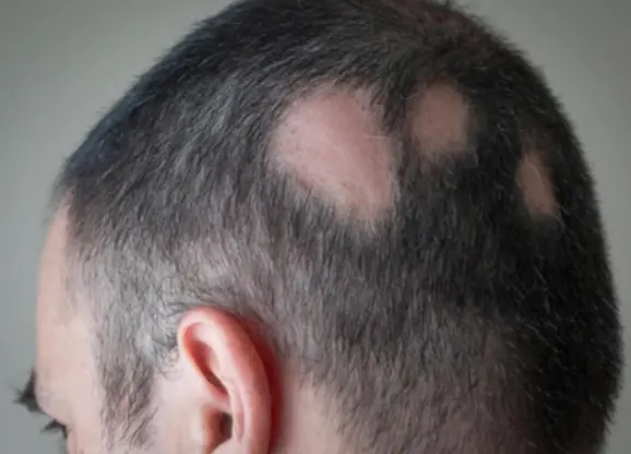 Derma-OSBE-1748023149403.webp|214x154