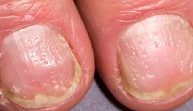 Derma-OSBE-1748023166331.webp|230x133