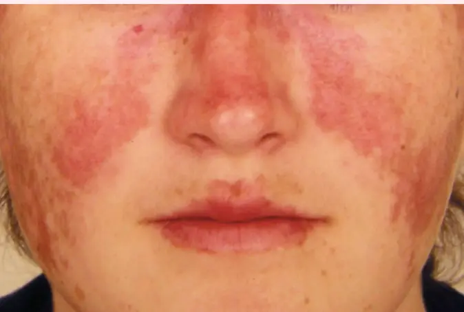 Derma-OSBE-1748023189966.webp|264x177