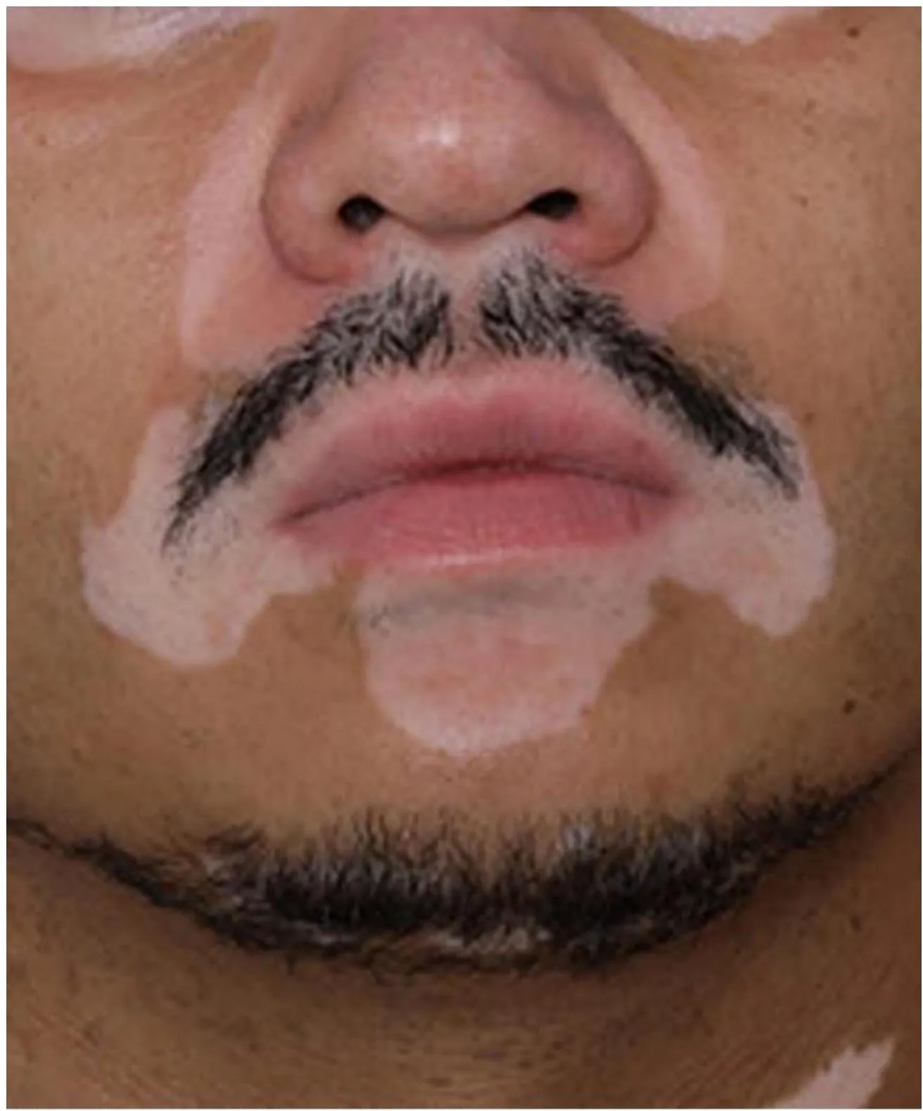 Derma-OSBE-01fda31362268b26.webp|155x187