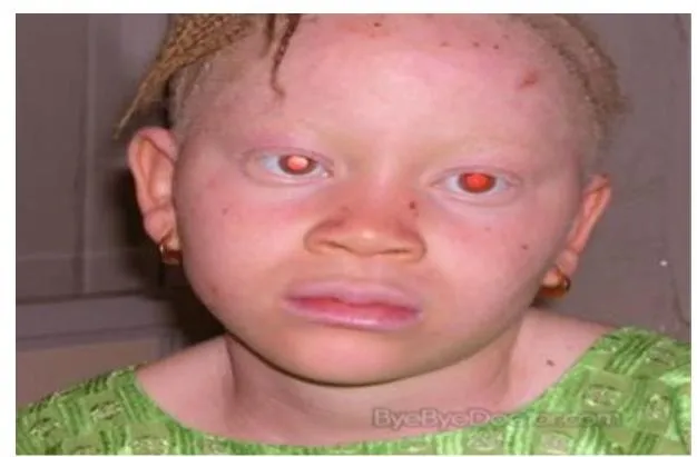 Derma-OSBE-1f0c7743064b89f0.webp|230x151