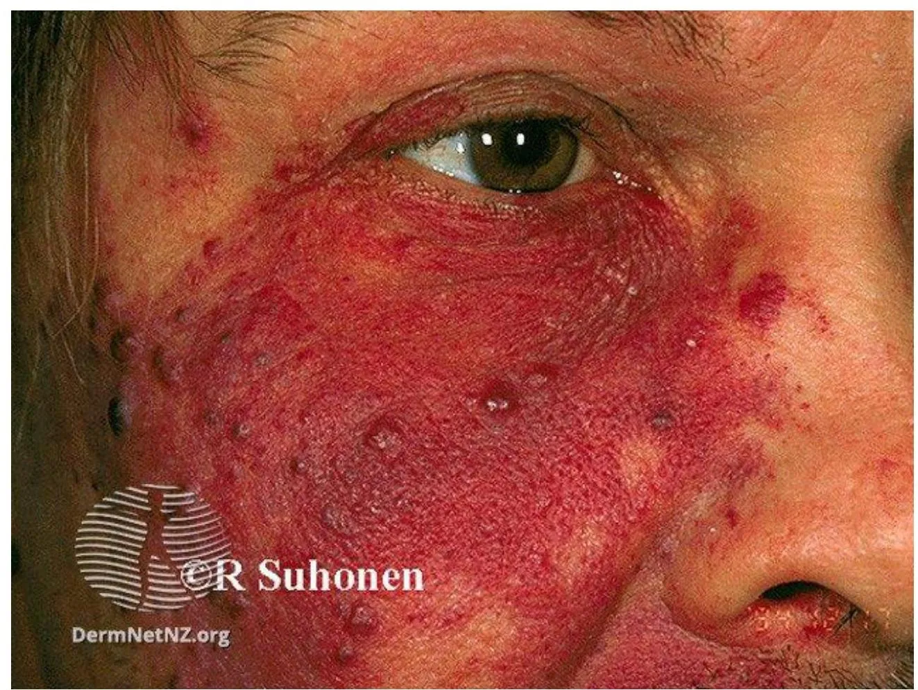 Derma-OSBE-695af39b6938b0c6.webp|171x128