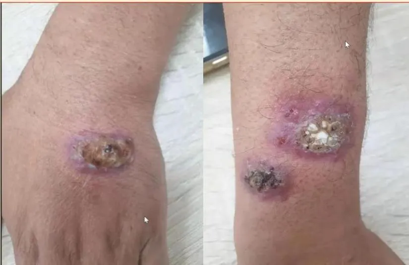 Derma-OSBE-75b826366bb64ccd.webp|225x146