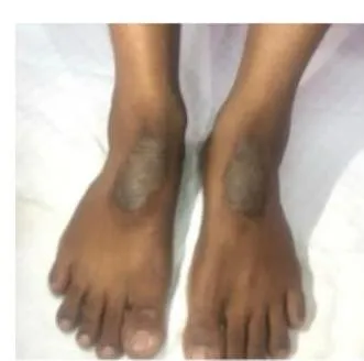 Derma-OSBE-9c1d8b3c3523f08a.webp|181x179