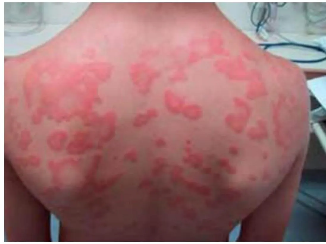 Derma-OSBE-b712a0d340d0e18f.webp|178x134