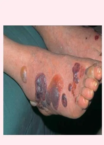 Derma-OSBE-cf8a24be7aa6d84c.webp|162x226