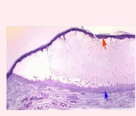 Derma-OSBE-dd671cd076a4fd2d.webp|175x226