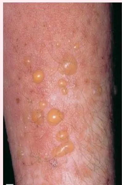 Derma-OSBE-e5d67c7548c63463.webp|143x216