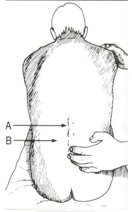 Palpation Example