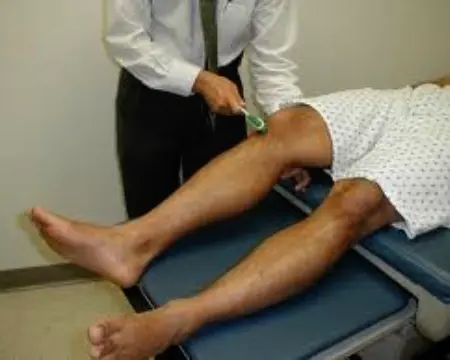 Knee Reflex
