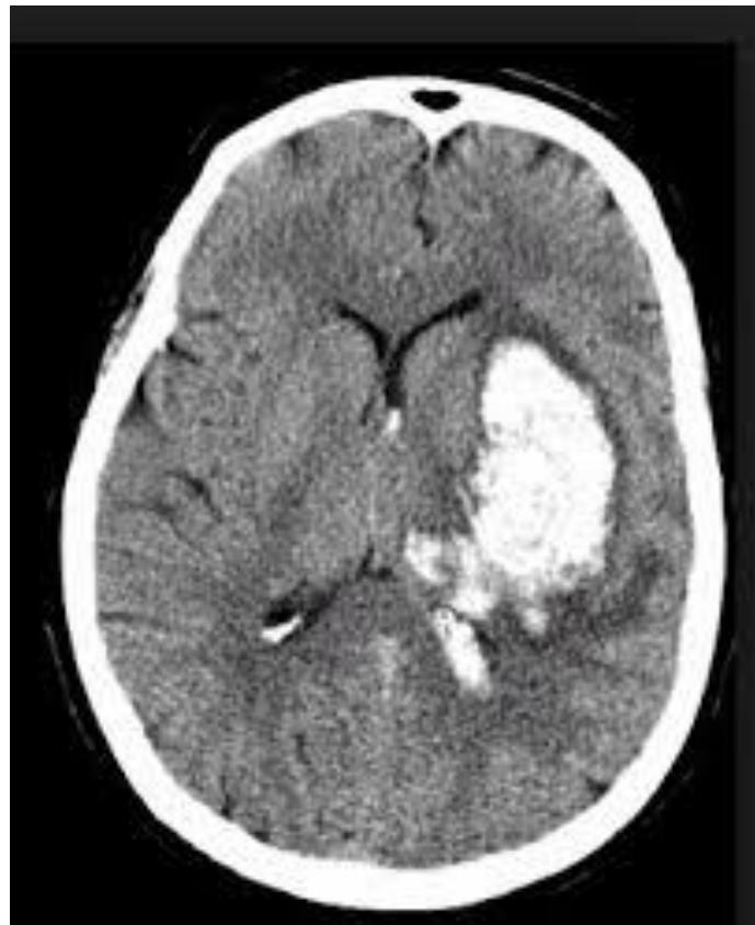 _page_103_Picture_2.jpeg|307x376