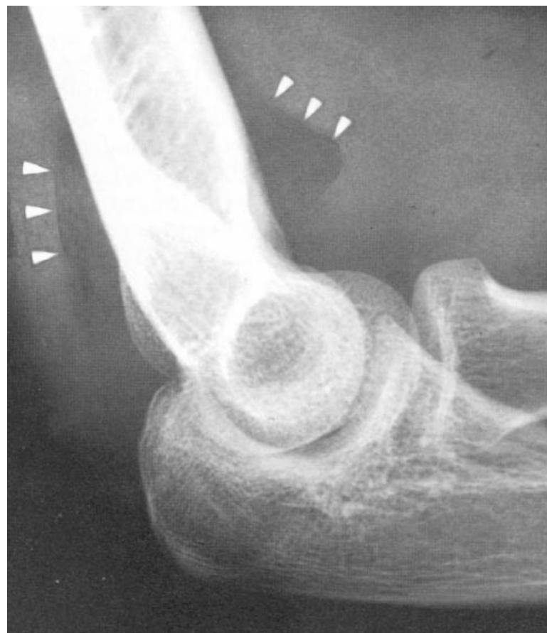 _page_106_Picture_4.jpeg|301x349