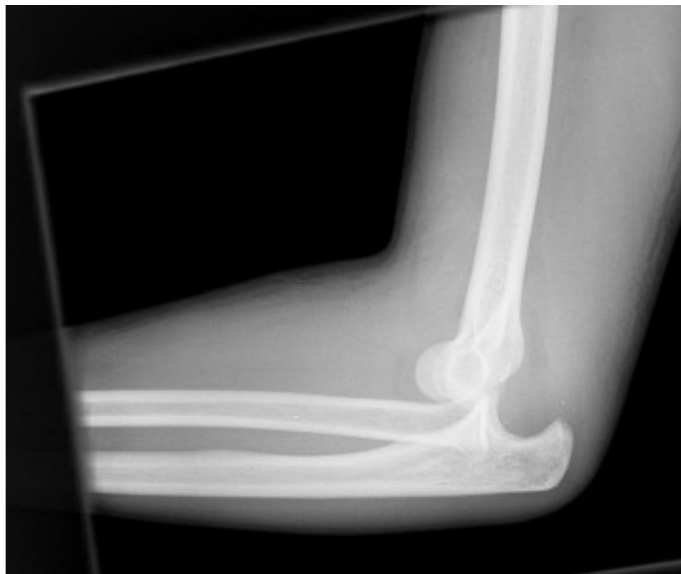 _page_107_Picture_4.jpeg|374x316