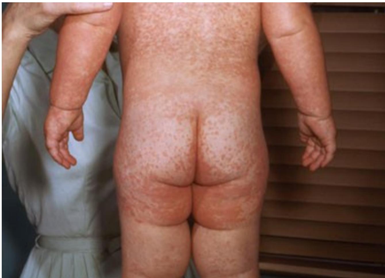 _page_111_Picture_3.jpeg|291x210