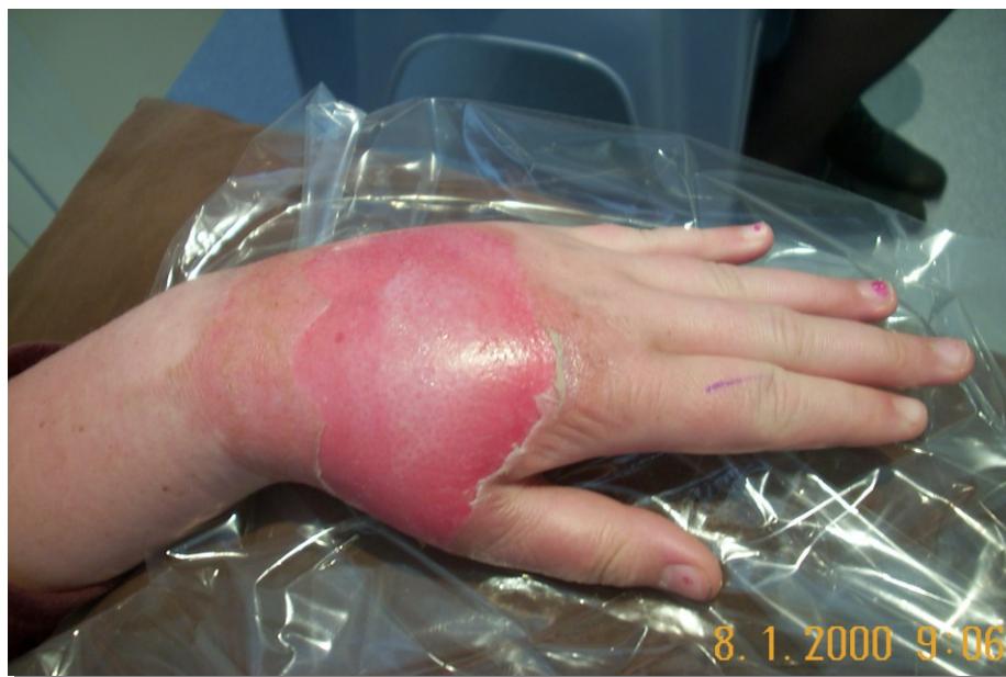 _page_112_Picture_6.jpeg|243x164