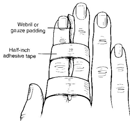 _page_114_Picture_5.jpeg|286x265