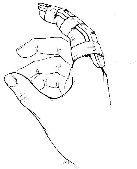 _page_114_Picture_6.jpeg|214x263