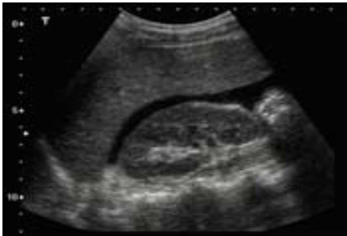 _page_123_Picture_4.jpeg|338x230