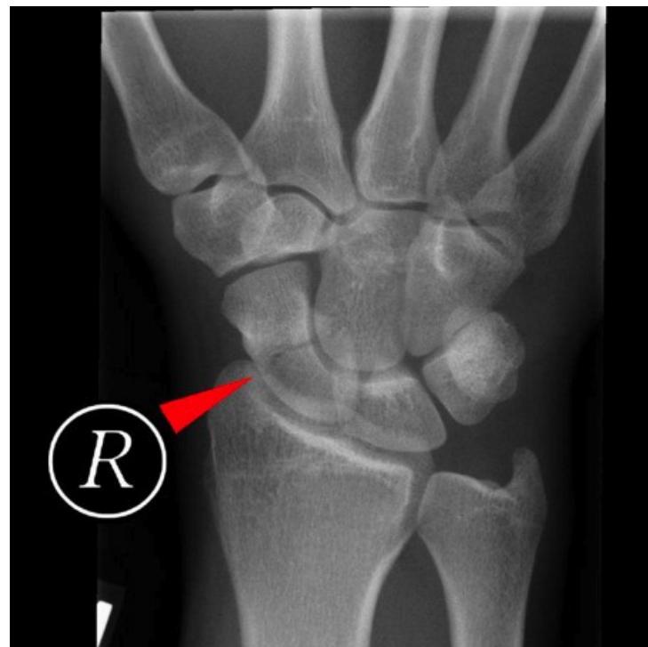 _page_124_Picture_1.jpeg|319x318