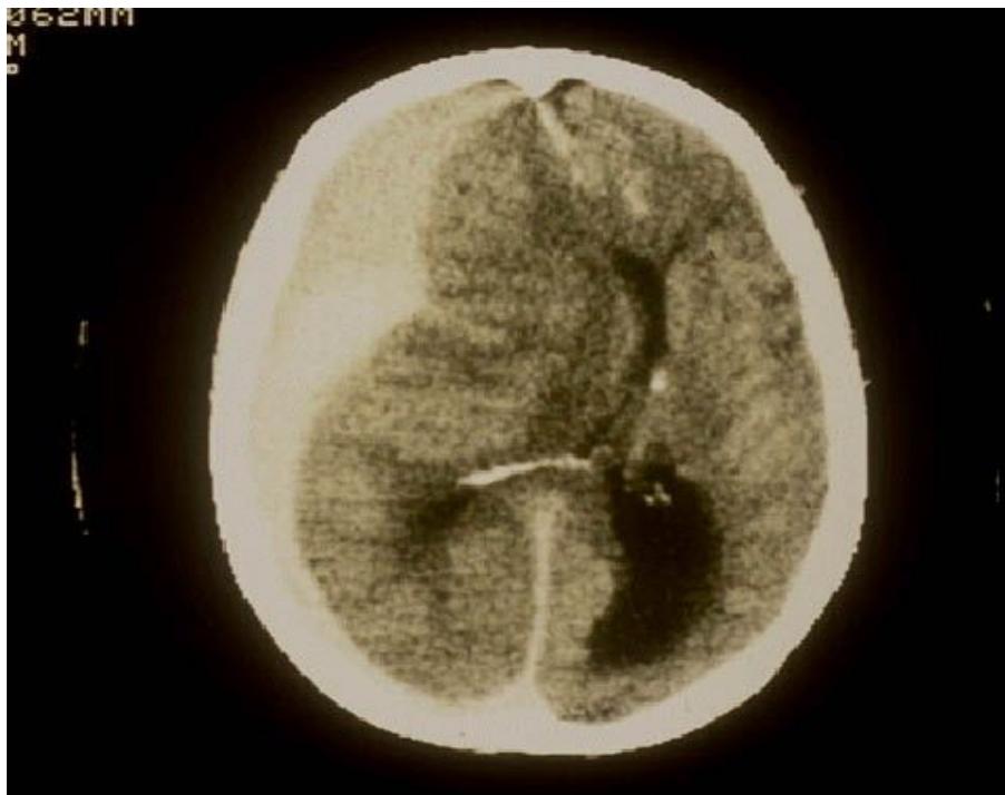 _page_127_Picture_5.jpeg|338x268