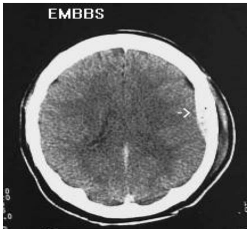 _page_128_Picture_3.jpeg|285x265