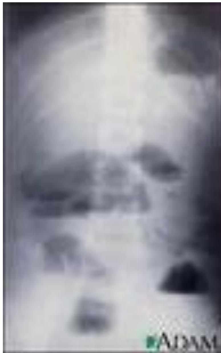 _page_129_Picture_4.jpeg|167x267