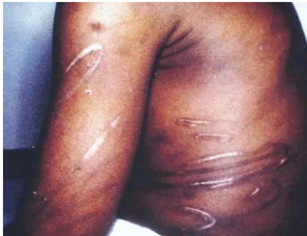 _page_75_Picture_3.jpeg|251x192