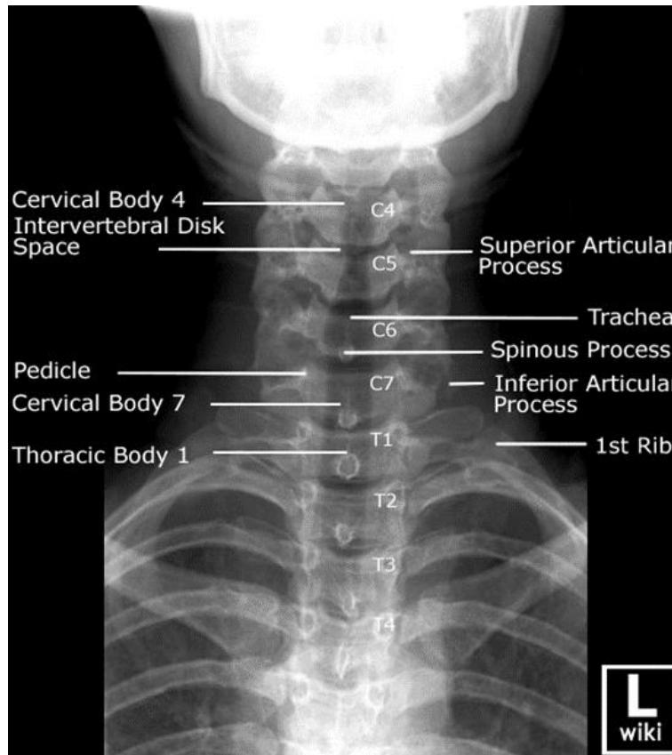 _page_78_Picture_1.jpeg|340x382