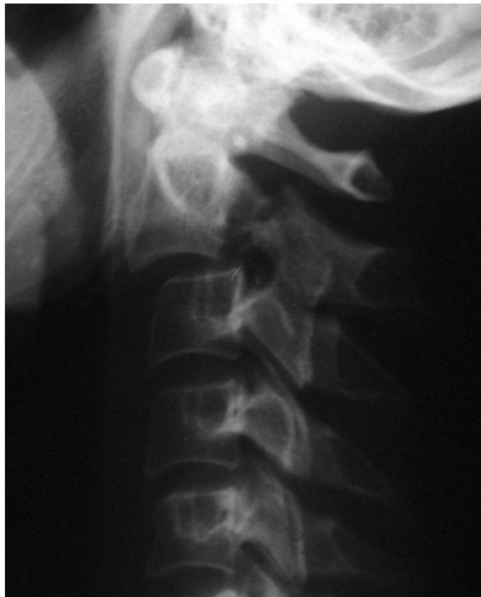 _page_80_Picture_2.jpeg|264x327