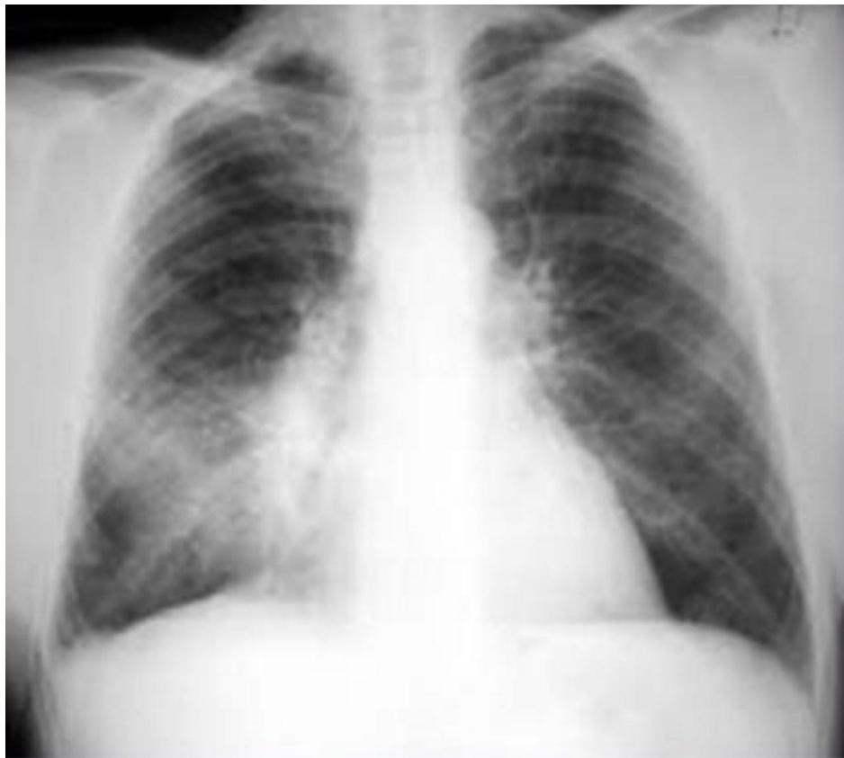 _page_82_Picture_6.jpeg|326x293