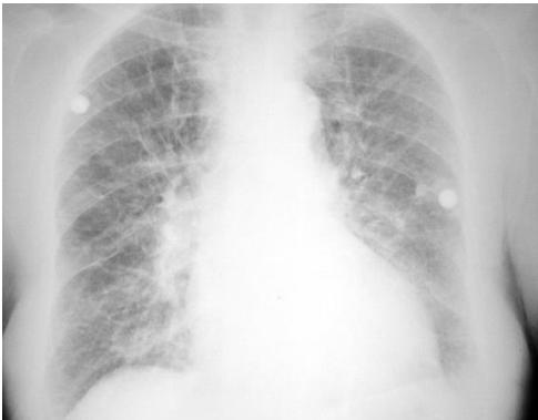 _page_84_Picture_0.jpeg|330x258