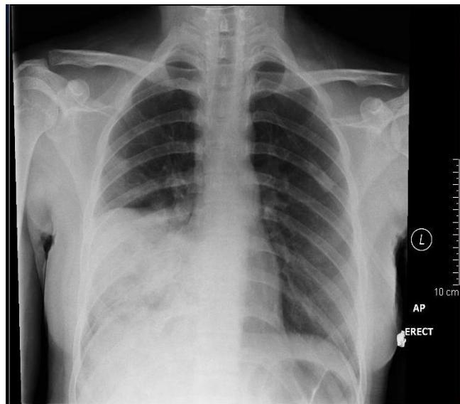 _page_85_Picture_3.jpeg|355x311