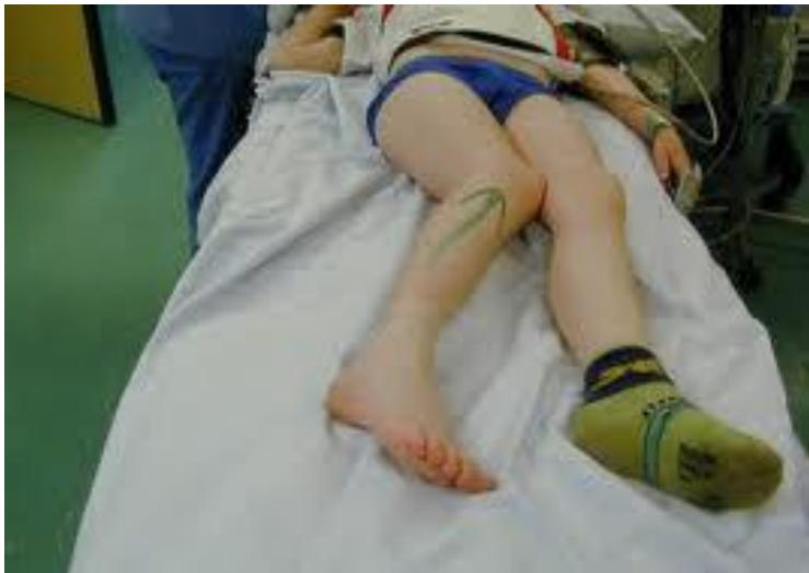 _page_95_Picture_3.jpeg|350x248